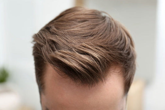 The Basics of Men’s Hair Systems: An Introduction